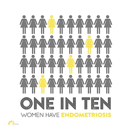 graphic to show, one in ten women have endometriosis