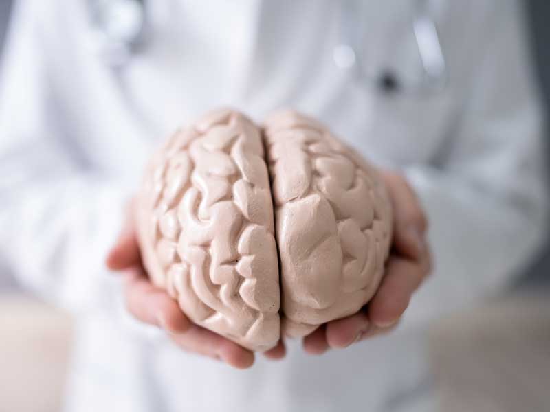 A doctor holding a brain impacted by health conditions that contributed to the development of Alzheimer’s disease